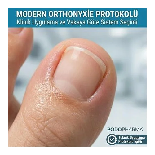 Modern Orthonyxie Protokolü: Biyomekanik Analizden Klinik Uygulamaya Teknik Kılavuz