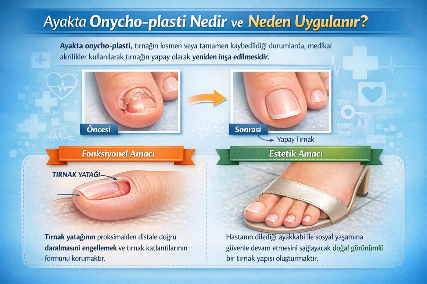 Teknik notlar ve Mykored