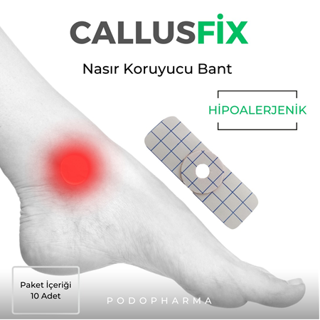 CALLUSFİX NASIR KORUYUCU BANT